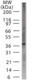 Anti-ASB11 antibody used in Western Blot (WB). GTX13711