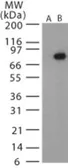 Anti-Bacillus anthracis protective antigen antibody used in Western Blot (WB). GTX13808