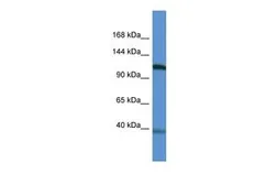 Anti-Myocardin antibody, N-term used in Western Blot (WB). GTX13842