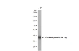 hCG beta protein, His tag. GTX138833-pro