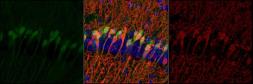 Anti-GFP antibody used in Immunohistochemistry (IHC). GTX13970