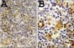 Anti-Caspase 1 antibody used in IHC (Paraffin sections) (IHC-P). GTX14368