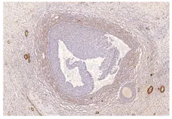 Anti-PDE8A antibody used in Immunohistochemistry (IHC). GTX14618