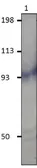 Anti-PDE11A antibody used in Western Blot (WB). GTX14623