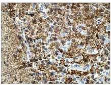 Anti-Calretinin antibody used in IHC (Paraffin sections) (IHC-P). GTX14689