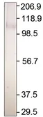 Anti-Adenylate cyclase 2 antibody used in Western Blot (WB). GTX14777