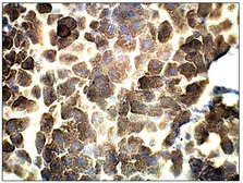 Anti-ADCY3 antibody used in IHC (Paraffin sections) (IHC-P). GTX14778