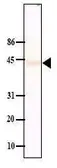 Anti-PPM1A antibody [p6c7] used in Western Blot (WB). GTX14824