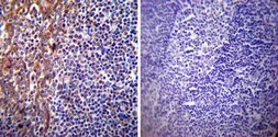 Anti-Presenilin 1 antibody [APS 18] used in IHC (Paraffin sections) (IHC-P). GTX15458