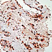 Anti-PDGF Receptor alpha antibody (Ready-to-use) used in IHC (Paraffin sections) (IHC-P). GTX15501