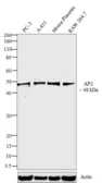 Anti-AP2 alpha antibody [3B5] used in Western Blot (WB). GTX15878