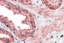 Anti-CCNDBP1 antibody, C-term used in IHC (Paraffin sections) (IHC-P). GTX15960