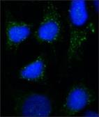 Anti-RAB7A antibody [Rab7-117] used in Immunocytochemistry/ Immunofluorescence (ICC/IF). GTX16196