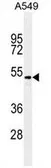 Anti-TGF beta 2 antibody [220ct16.4.3.1] used in Western Blot (WB). GTX16335
