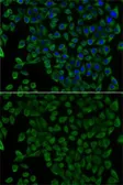 Anti-Transcobalamin 2 antibody used in Immunocytochemistry/ Immunofluorescence (ICC/IF). GTX16437