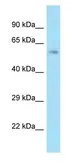 Anti-ACBD3 antibody, Internal used in Western Blot (WB). GTX16579