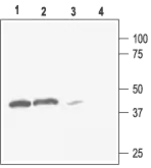 Anti-KIR2.3 antibody used in Western Blot (WB). GTX16644