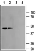 Anti-Kir2.2 antibody used in Western Blot (WB). GTX16651