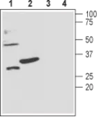 Anti-KCNMB3 antibody used in Western Blot (WB). GTX16677