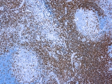 Anti-CD3 antibody (ready-to-use) used in IHC (Paraffin sections) (IHC-P). GTX16930