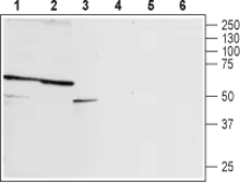 Anti-P2X2 antibody used in Western Blot (WB). GTX16933