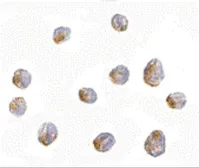 Anti-LIS1 antibody used in Immunocytochemistry/ Immunofluorescence (ICC/IF). GTX16993