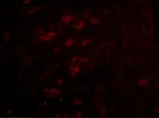 Anti-LASS6 antibody used in IHC (Paraffin sections) (IHC-P). GTX17028