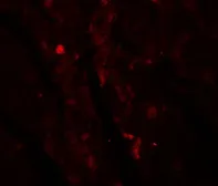 Anti-IDH2 antibody used in IHC (Paraffin sections) (IHC-P). GTX17090