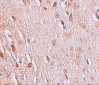 Anti-WIZ antibody used in IHC (Paraffin sections) (IHC-P). GTX17094