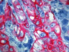 Anti-Cytokeratin 5 + 6 antibody [D5/16 B4] used in IHC (Paraffin sections) (IHC-P). GTX17133