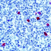 Rabbit Anti-Human IgM antibody. GTX17150