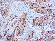 Anti-Desmin antibody [D33] used in IHC (Paraffin sections) (IHC-P). GTX17156