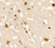 Anti-AIG1 antibody used in IHC (Paraffin sections) (IHC-P). GTX17168
