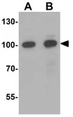 Anti-SIDT2 antibody used in Western Blot (WB). GTX17188