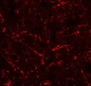 Anti-MIP1 beta antibody used in IHC (Paraffin sections) (IHC-P). GTX17201