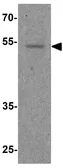 Anti-FOXG1 antibody used in Western Blot (WB). GTX17231