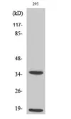 Anti-Caspase 6 (cleaved Asp179) antibody used in Western Blot (WB). GTX17383