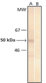 Anti-Phosphoserine antibody [3C171] used in Western Blot (WB). GTX17465