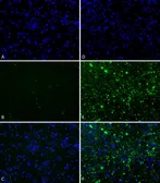 Human alpha Synuclein protein (Pre-Formed Fibrils). GTX17667-pro