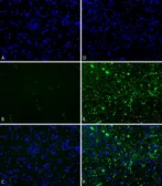 Human alpha Synuclein protein (active, Pre-Formed Fibrils). GTX17669-pro