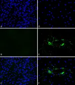 Mouse alpha Synuclein protein (active, Pre-Formed Fibrils). GTX17671-pro