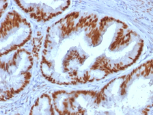 Anti-Estrogen Receptor alpha antibody [ESR1/1935] used in IHC (Paraffin sections) (IHC-P). GTX17904