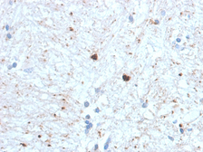 Anti-Ubiquitin antibody [UBB/1748] used in IHC (Paraffin sections) (IHC-P). GTX18045