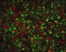 Anti-PCNA antibody [PC10] used in Immunocytochemistry/ Immunofluorescence (ICC/IF). GTX20029