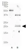 Anti-p19ARF antibody used in Western Blot (WB). GTX20080