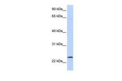 Anti-CHAC1 antibody, C-term used in Western Blot (WB). GTX20259