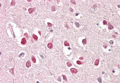 Anti-BAIAP2 (isoform 3) antibody used in IHC (Paraffin sections) (IHC-P). GTX20791