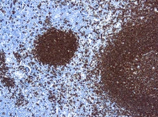 Anti-CD20 antibody [L26] (ready-to-use) used in IHC (Paraffin sections) (IHC-P). GTX20840