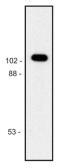 Anti-beta Galactosidase antibody [BG-02] used in Western Blot (WB). GTX21047