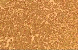 Anti-CCR3 antibody used in Immunocytochemistry/ Immunofluorescence (ICC/IF). GTX21667